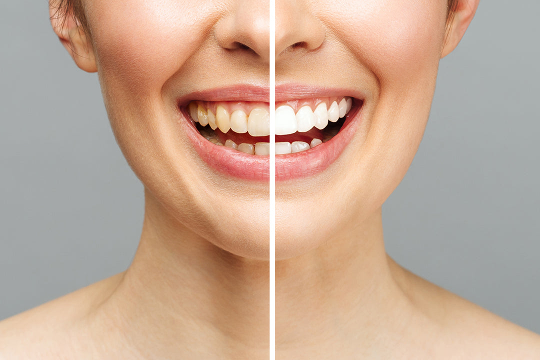 How to use purpl strips